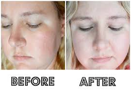 skincare3.1