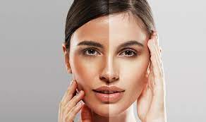 skincare4